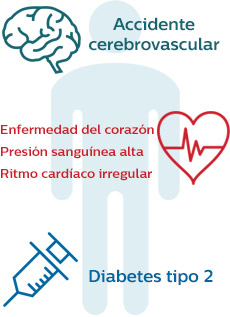 La apnea del sue&ntilde;o sin tratar puede resultar en una serie de problemas de salud