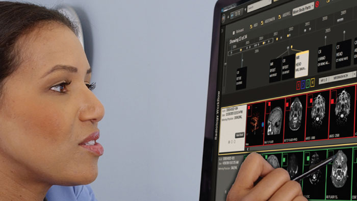 Soluci&oacute;n IntelliSpace Radiology Workspace