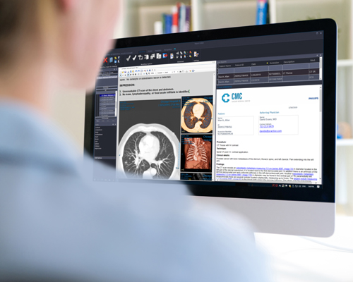 Doctora que utiliza Diagnostic Viewer para examinar imágenes de RM con perfusión