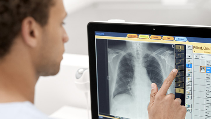 Radiograf&iacute;a exclusiva - Unique 2