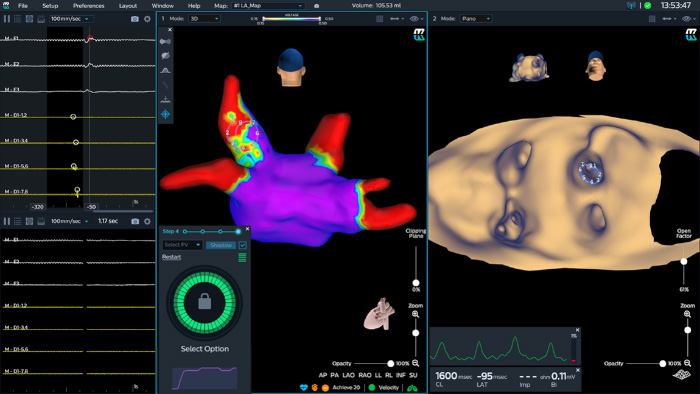 Adquisici&oacute;n de im&aacute;genes diel&eacute;ctricas