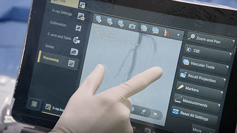 Presentamos la nueva generaci&oacute;n de Azurion de Philips para radiolog&iacute;a intervencionista