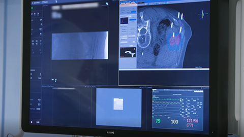 Testimonio de usuarios sobre Azurion 7 C20 de Philips St. Antonius Nieuwegein, Pa&iacute;ses Bajos