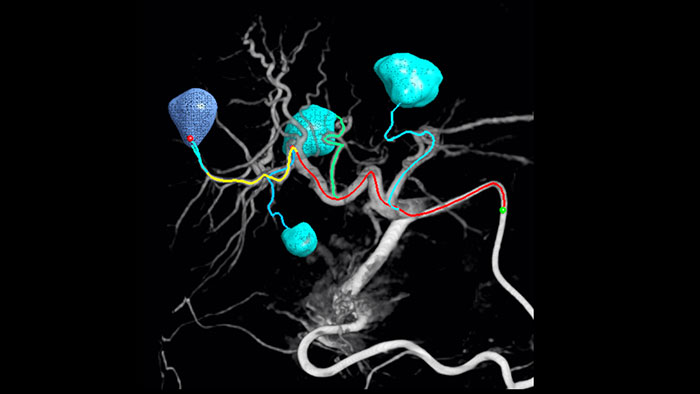 Navegaci&oacute;n por im&aacute;genes de EmboGuide