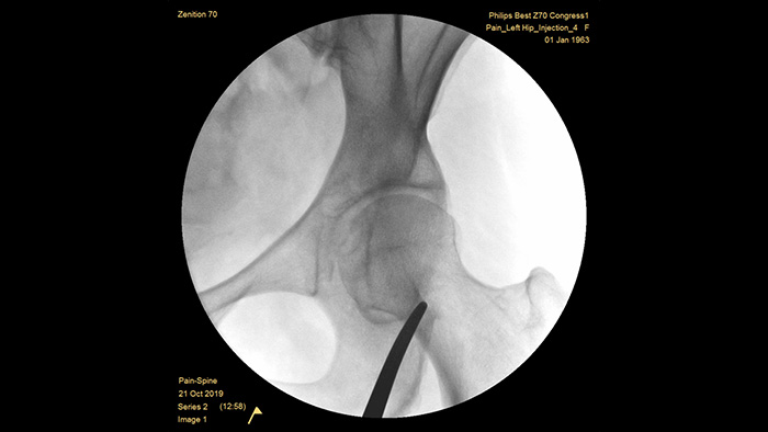 Mejora autom&aacute;tica de im&aacute;genes
