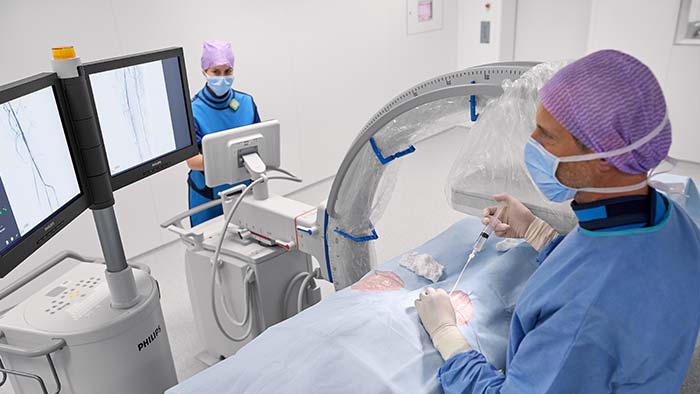 Arcos de quirófanos para aplicaciones vasculares