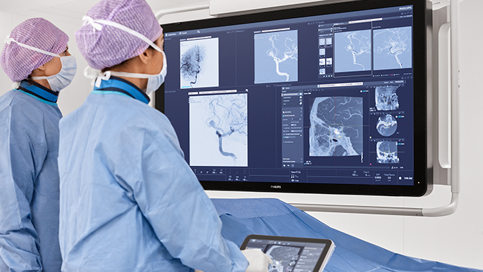 Miniatura de atenci&oacute;n neurovascular