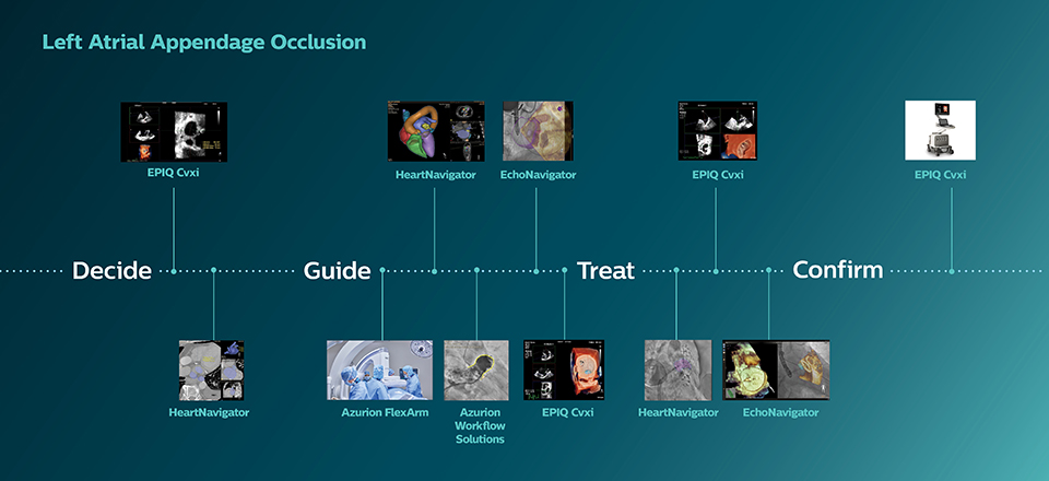 Oclusi&oacute;n de la orejuela izquierda