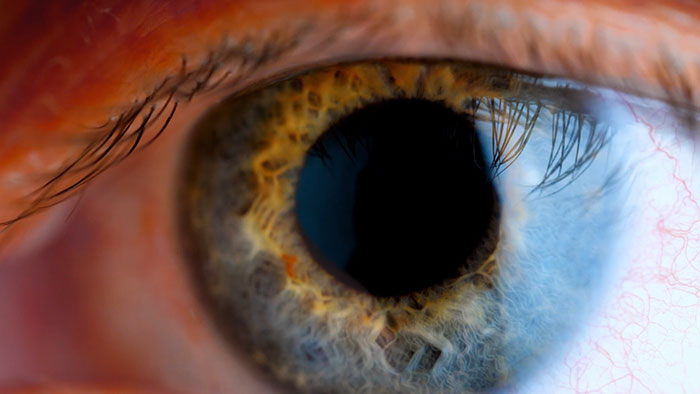 Ec&oacute;grafo intervencionista EPIQ CVxi