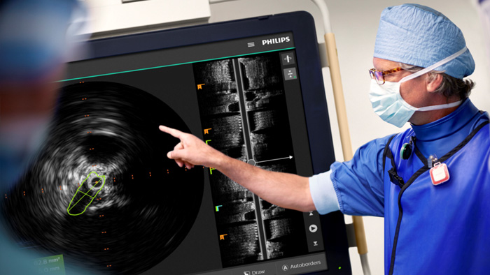 Procedimientos venosos