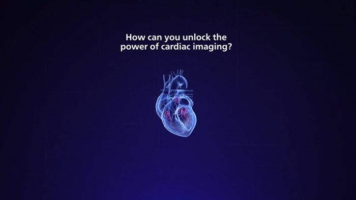 miniatura de v&iacute;deo, im&aacute;genes cardiacas en el ESC de 2022