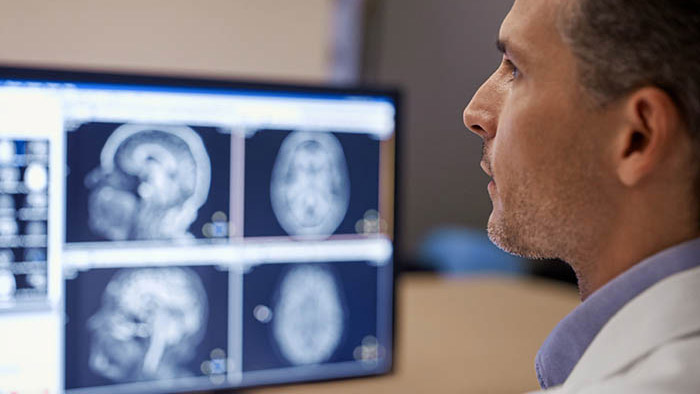 El valor Compressed SENSE en la pr&aacute;ctica