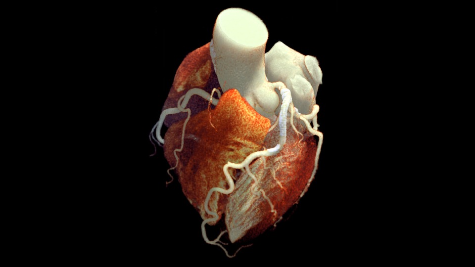 Cardiaco Visual