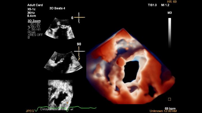 Exploraci&oacute;n X5 1C TrueVue
