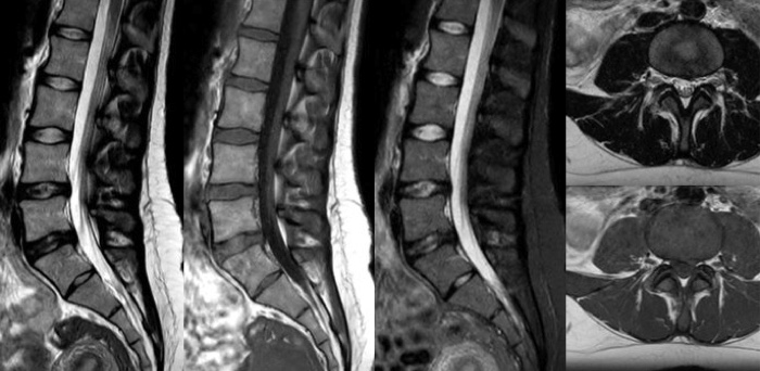 Miniatura de ocho minutos