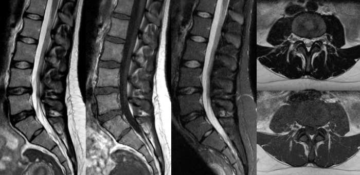 Miniatura de diecis&eacute;is minutos