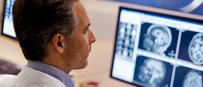 Philips Compressed Sense