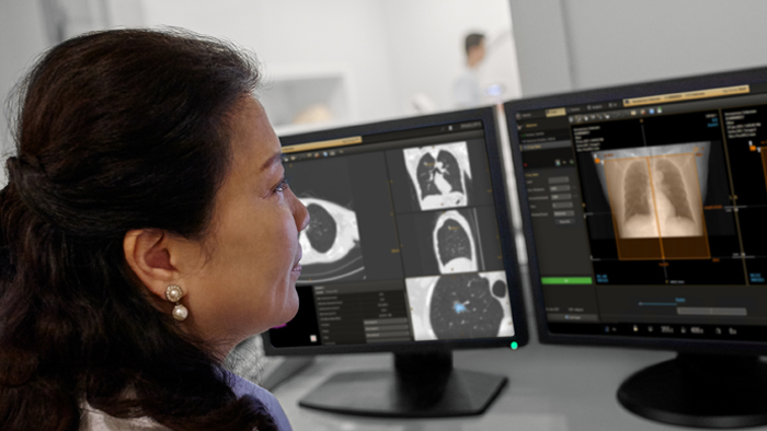 Valor de los radi&oacute;logos