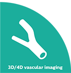 Im&aacute;genes vasculares 3D