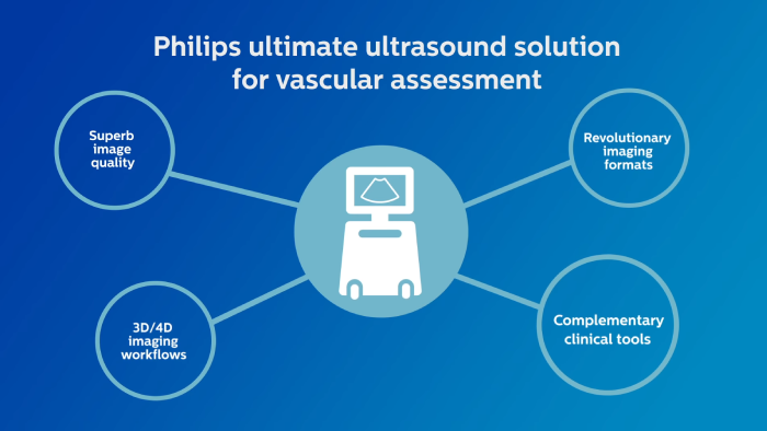 V&iacute;deo en el que se describe la soluci&oacute;n definitiva para la evaluaci&oacute;n vascular de Philips