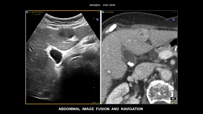 Fusi&oacute;n de im&aacute;genes con la navegaci&oacute;n