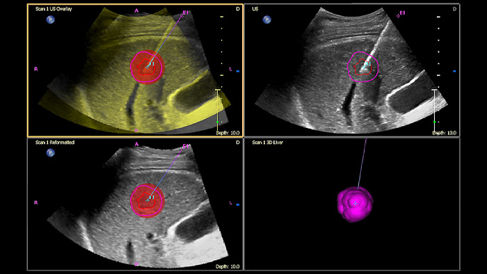 Imagen de exploraci&oacute;n