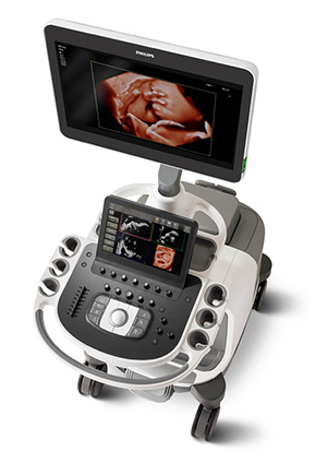 Sistema de ultrasonidos Epiq 7 de Philips para obstetricia y ginecolog&iacute;a