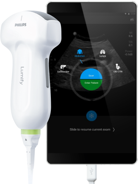 Philips Lumify aplicaci&oacute;n
