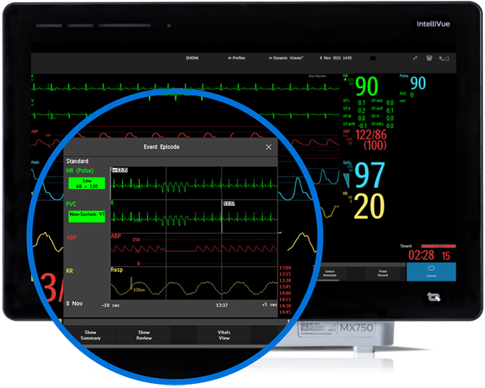 Versi&oacute;n de escritorio de la monitorizaci&oacute;n de sucesos avanzada