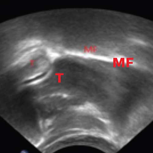 Biomec&aacute;nica de la alimentaci&oacute;n de los lactantes, informaci&oacute;n cient&iacute;fica para matronas y profesionales sanitarios