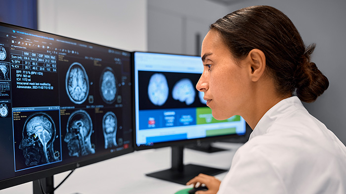 MR technologist reviewing neuro images in AI reporting -  