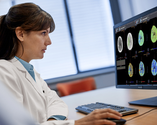Doctora que utiliza Diagnostic Viewer para examinar im&aacute;genes de RM con perfusi&oacute;n