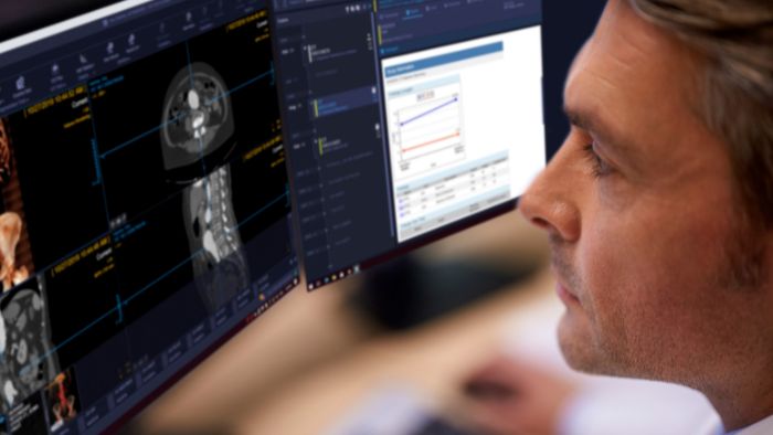 Sistemas inform&aacute;ticos para radiolog&iacute;a