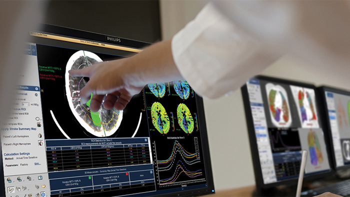 Soluciones de flujo de trabajo de radiología 