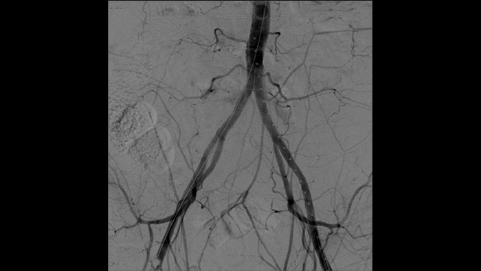 Procesamiento vascular
