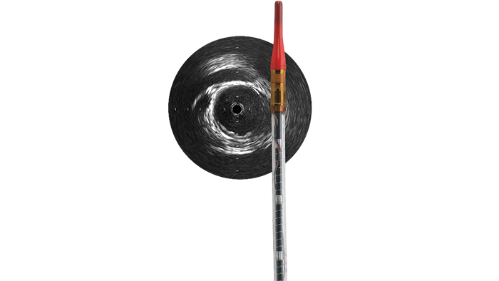IVUS de Philips