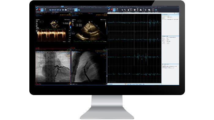 Pantalla de la interfaz del m&oacute;dulo de diagn&oacute;stico de cardiolog&iacute;a en un monitor