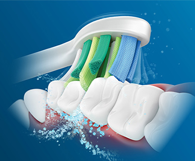 Evaluaci&oacute;n cl&iacute;nica del cabezal de cepillado Philips Sonicare InterCare