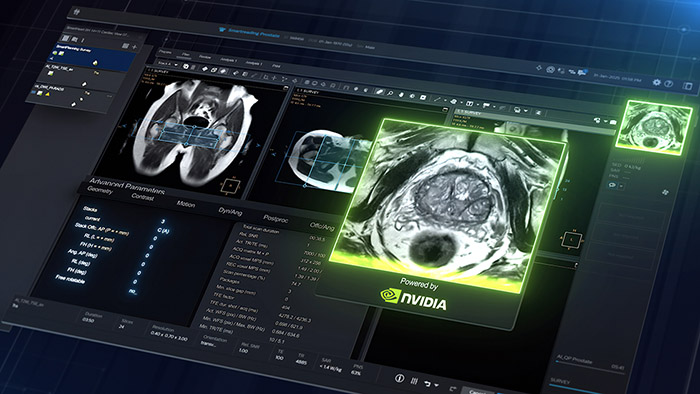 Ver antes de escanear: la &ldquo;vista previa predictiva&rdquo; de Philips en el camino hacia una RM m&aacute;s aut&oacute;noma