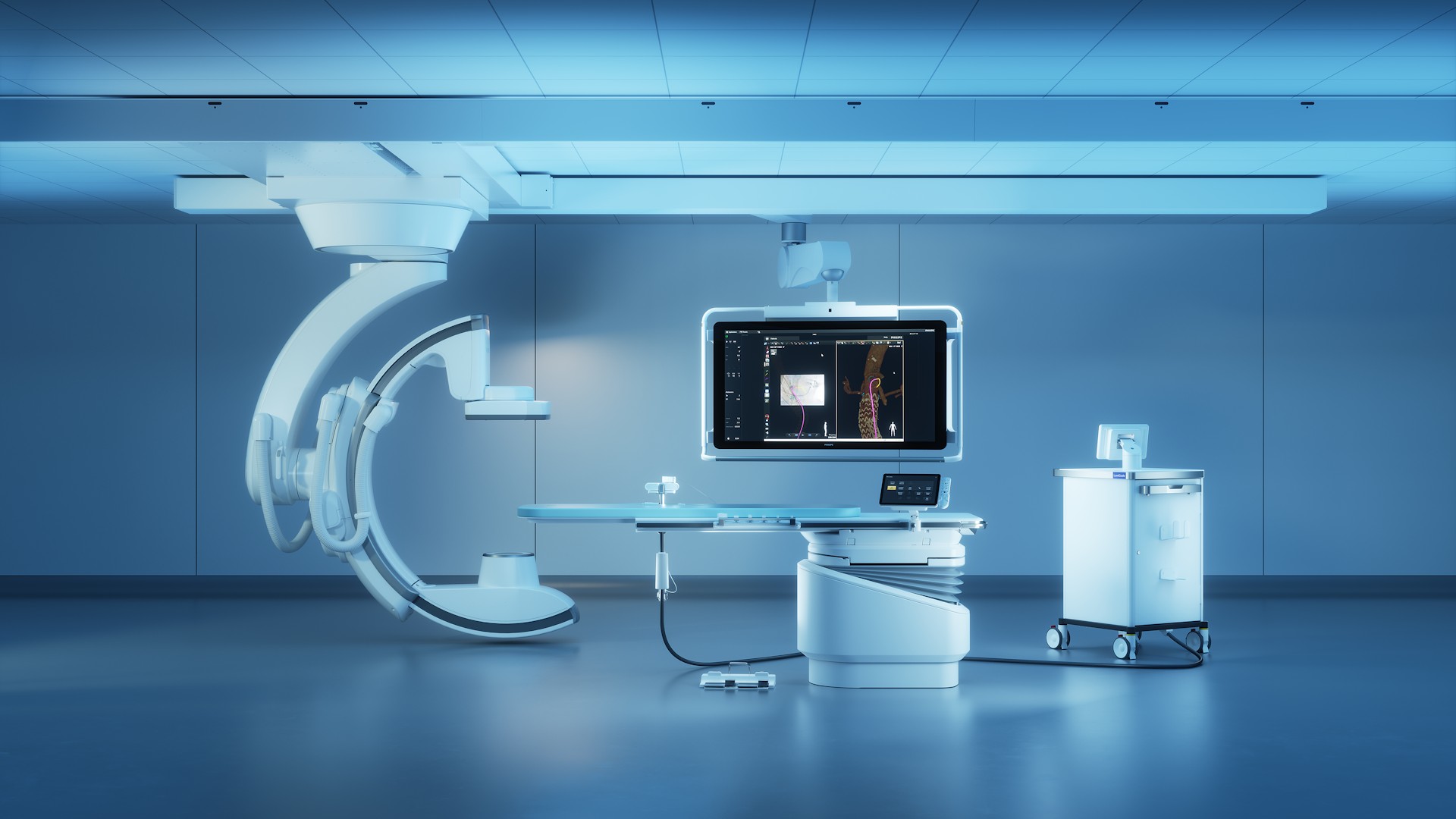 Philips presenta en SEACVE 2026 el futuro de la navegaci&oacute;n endovascular 3D guiada por luz con LumiGuide